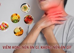 Viêm họng nên ăn gì, không nên ăn gì để nhanh khỏi bệnh?